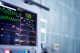 ECG