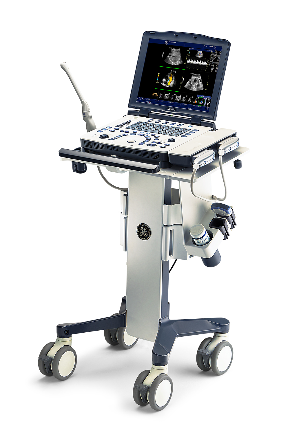Ultrasound
